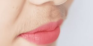 hirsutisme lèvre supérieure femme